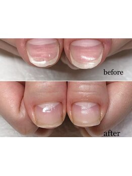 ハンドケアが得意なサロン