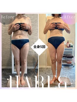 ハレアンド(Hare&)/60代全身5回目Before After