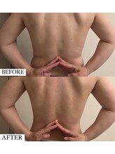 フェミニー(Feminy)/ハミ肉撃退