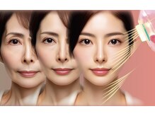 クレール(Claire)/美肌育成温熱リバースケア