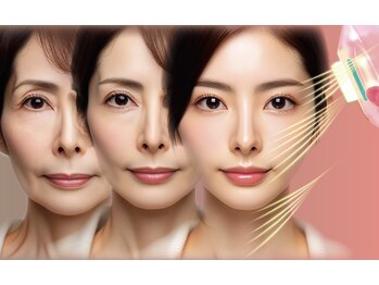 クレール(Claire)/美肌育成温熱リバースケア