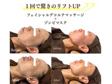 クーポン【たるみ・くすみ】リフトアップフェイシャル　90分