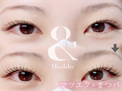 デイジー(Daisy)の写真