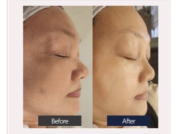 エスビーエス オキナワ(SBS OKINAWA)/第5世代ダクトピールモニター様