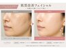 【リピーター用】 若見えコース/年齢に応じたエイジング￥8000