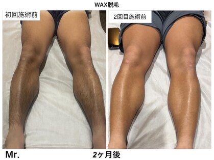 ミスター(Mr.)の写真