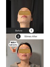 ふらっとエステ/あなたの物語を、もっと美しく。