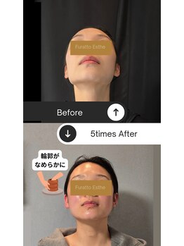 ふらっとエステ/あなたの物語を、もっと美しく。