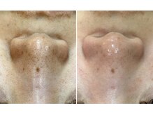 トータルビューティーサロン ナーズ(NAZ)/