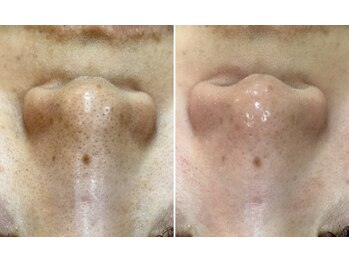 トータルビューティーサロン ナーズ(NAZ)/