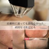 リメレ(Rimere)