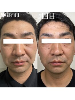 コリー(Kolly)/男性のお客様も歓迎です！