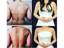 レゾン 京橋店/【Before/after】ブライダル