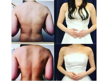 レゾン 京橋店/【Before/after】ブライダル