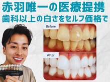 スマイルホワイト 赤羽店