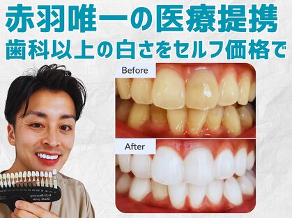スマイルホワイト 赤羽店の写真