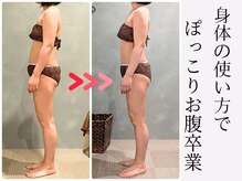 ツーアップ(2up)/産後ぽっこり腹,腰尻痛,猫背巻肩