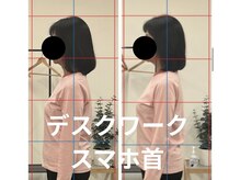 カワル整体 長嶺院/スマホ首