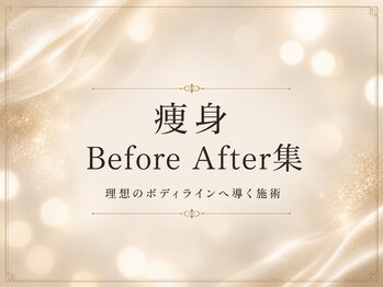 ウィクシム(Wixim)/