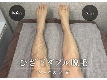 エーベース 横浜店(A-BASE)の写真