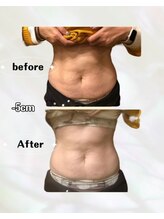 カリス(charis)/Before &After 