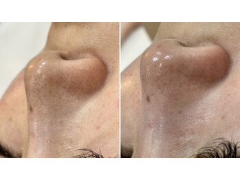 トータルビューティーサロン ナーズ(NAZ)/