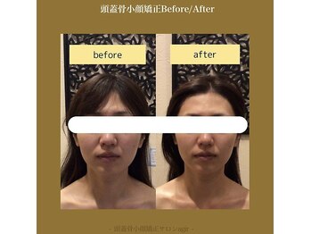 アジール 長岡リバーサイド千秋店(agir)/Before/After画像