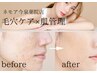 《人気No1》毛穴ケア×肌トーンUP 全顔フェイシャルWAX＋保湿パック付き/今泉