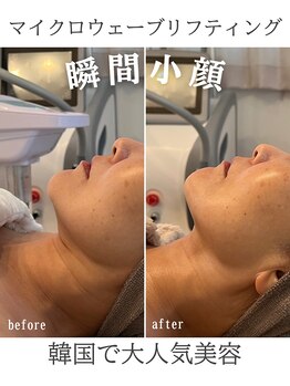 リリー(LILY)/韓国美容 LILY