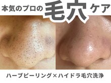 ハリト エステ(HaRi&)の雰囲気(本気の毛穴ケアでいちご鼻・開き毛穴ともおさらば!毛穴洗浄♪)