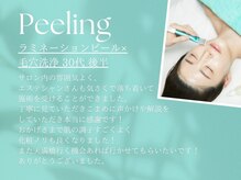 ルーシーガーデン(LUCY GARDEN)/30代/感想 ラミネーションピール