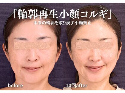 バンブー(bamboo)の写真