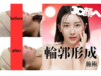 コリード(colead)の写真/理想の小顔へ！写真映えする輪郭形成施術で、魅惑のフェイスラインをシャープに演出♪