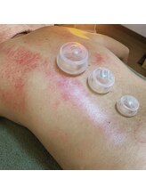 ディアローグ(Dialogue)/スライドカッピング