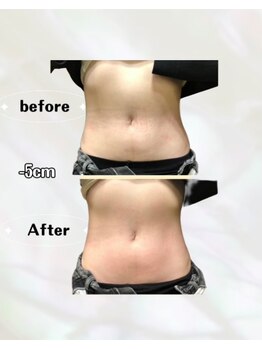 カリス(charis)/Before &After 