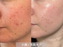 サロンディト(ditto)の雰囲気（ブライダルエステ(肌ケア&小顔ケア)、ネイイルも人気です(^^)）