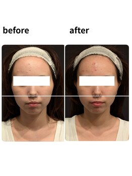 トリニティスペース(TrinitySpace)/レモンボトルビフォーアフター