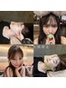 ★人気No.1【圧倒的な小顔へ】リフトアップ美容鍼+小顔矯正¥16500→8250