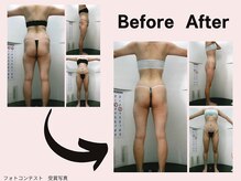 ミネルバエンダモロジー/エンダモロジー/痩身/ウェルネス