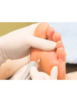 フットケアを受けたい