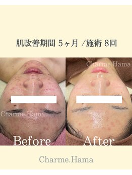 シャルム(Charme.)/オーダーメイドフェイシャル