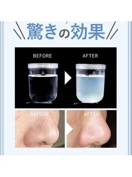 エステSi belleの写真/毛穴汚れ・ザラつきをすっきり♪つるんとなめらかな透明感肌へ