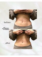 カリス(charis)/Before &After 