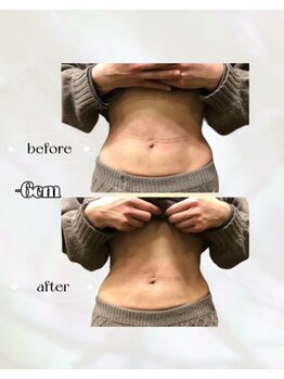 カリス(charis)/Before &After 