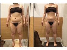 リッツ 柏店(Ritz)/【Before/After】痩身