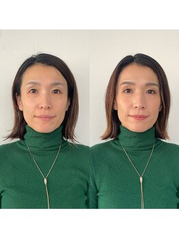パーソナルサンフラワー(PersonalSunflower)/お客様ヘアメイク Before/After