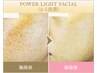 《肌お悩み解消◎》悩み別オプション付きパワーライト光フェイシャル¥25000