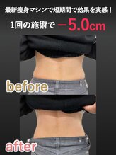 蓮子の夢/腰回り比較