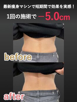 蓮子の夢/腰回り比較