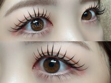 テディプラス(Teddy+)